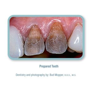 کامپوزیت پینک اپک کازمادنت / Cosmedent Creative Color Pink Opaque