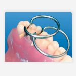 کیت کلمپ سکشنال ماتریکس Tor VM Clamp Ring Set 1.399